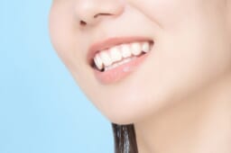 ラミネートベニアってどんな治療？セラミックと何が違うの？