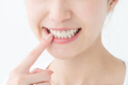 ラミネートベニア以外でおすすめの美容歯科③ホワイトニング